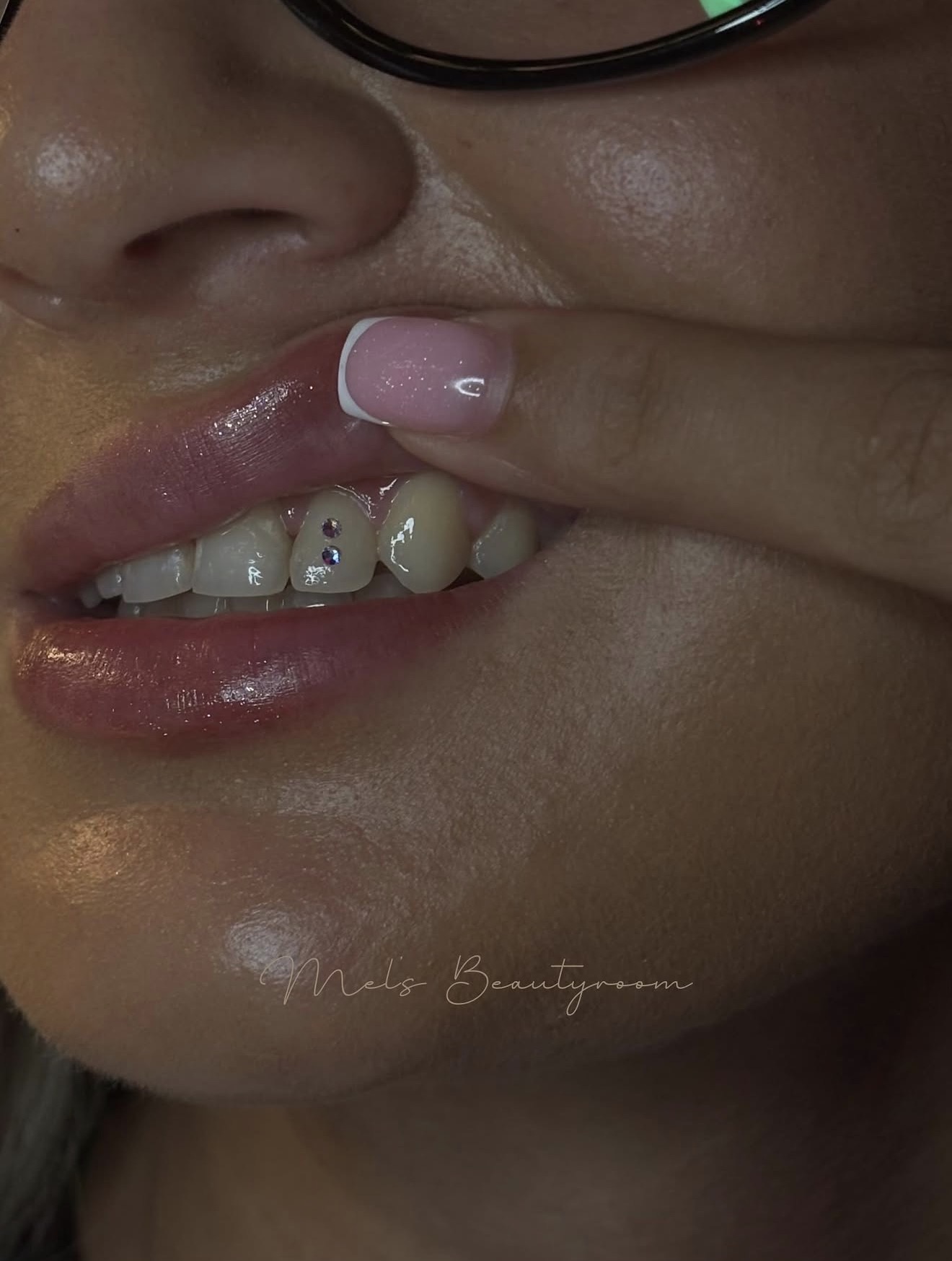 Fonkelende tooth gem accenten
