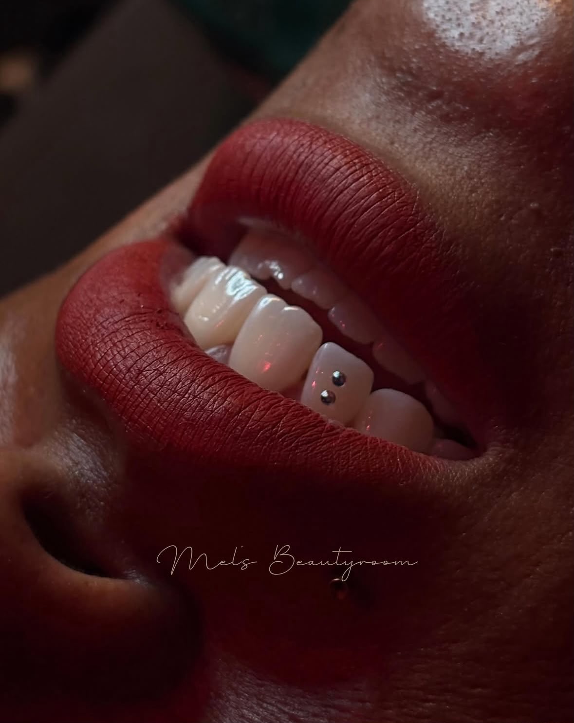 Tooth gems op de voortanden